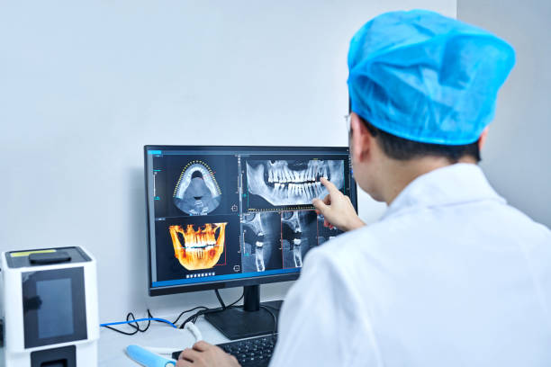 Best Emergency Treatment for Dental Infections or Abscesses in Rancho Santa Margarita, CA