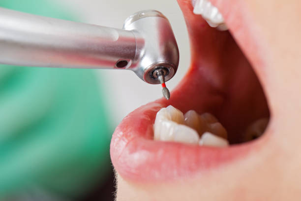 Best Emergency TMJ Treatment in Rancho Santa Margarita, CA